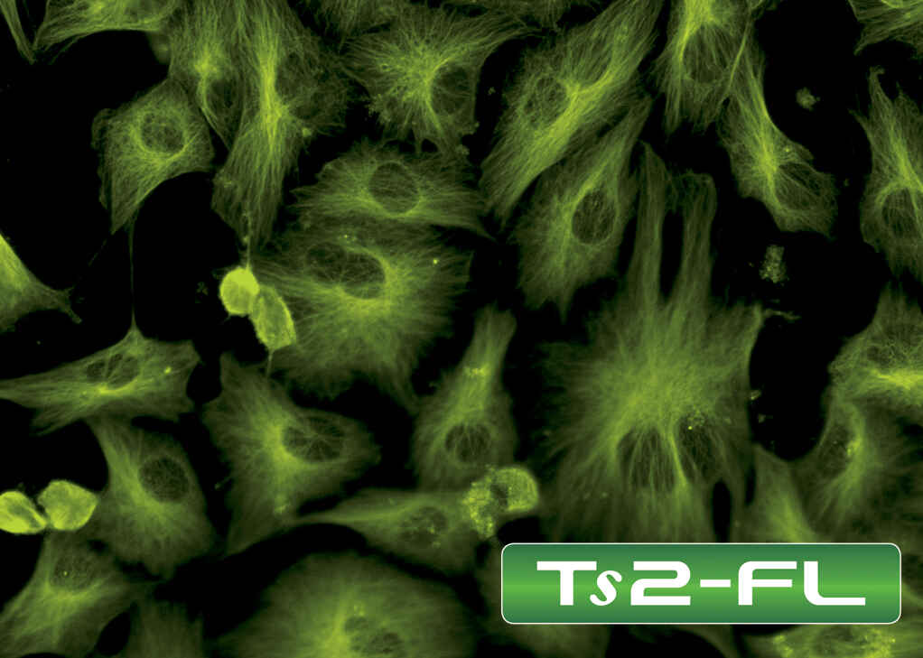 LED-based high-quality Epi-fluorescence observation sample image captured on the Nikon ECLIPSE Ts2-FL