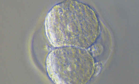 NAMC image at 40x magnification showing a flat, hazy specimen prior to Emboss Contrast processing on the Nikon ECLIPSE Ts2