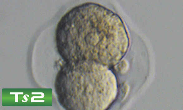Emboss Contrast image at 40x magnification showing pseudo-three-dimensional, glare-free specimen detail on the Nikon ECLIPSE Ts2